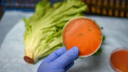 Listeria culture plate holding in hand against fresh vegetable romaine lettuce