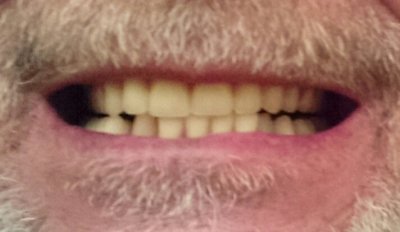 teeth.jpg